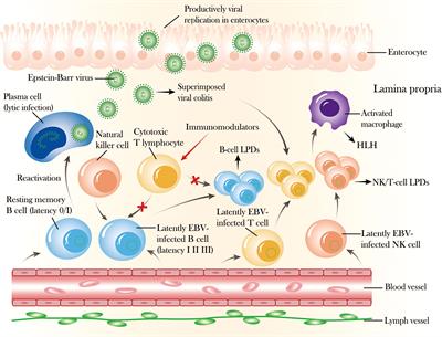 Impact of Epstein–Barr virus infection in patients with inflammatory bowel disease